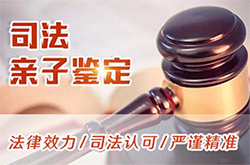 石家庄司法亲子鉴定怎么收费，石家庄司法DNA亲子鉴定如何办理