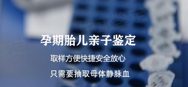 石家庄孕期亲子鉴定基本流程, 石家庄孕期亲子鉴定基本流程,